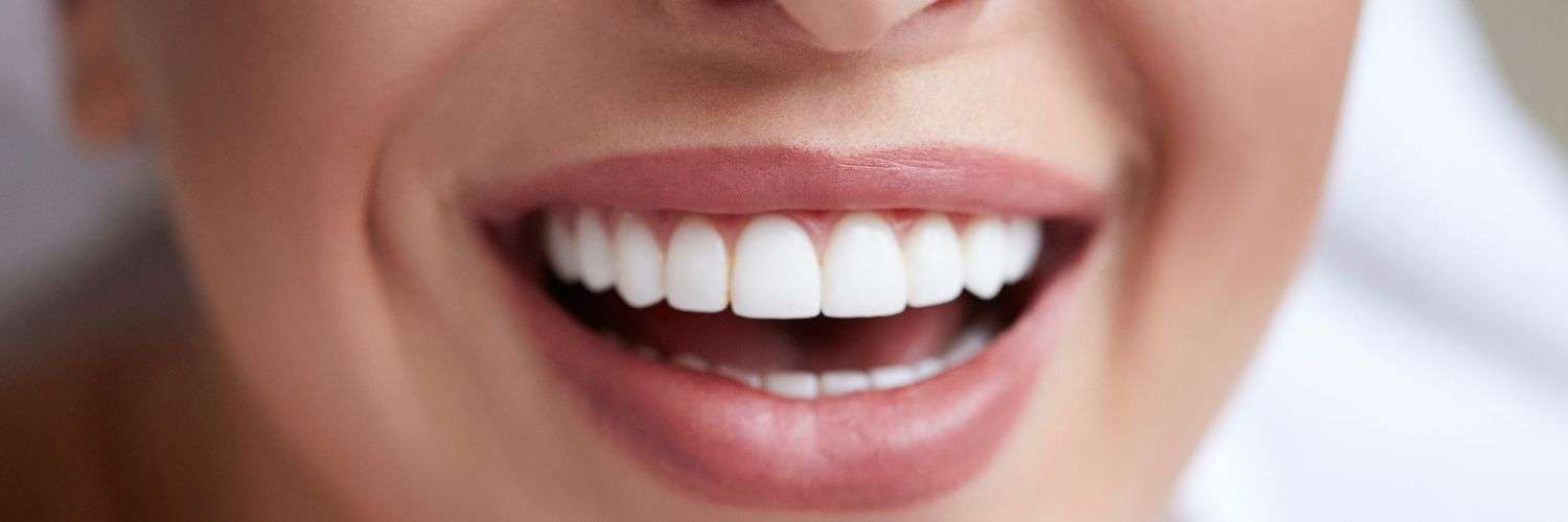 Teeth Whitening in Essex & Thurrock - Tooth Doctor