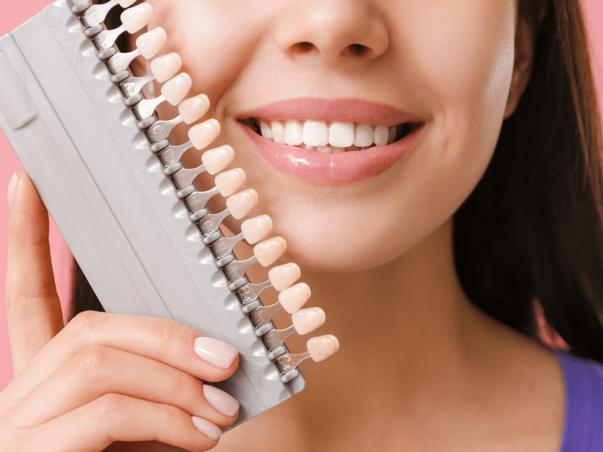 What are dental veneers - Tooth Doctor - Dentist in Essex and Thurrock