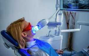 Teeth Whitening Procedure